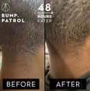 BUMP PATROL AFTERSHAVE TREATMENT MAX STRENGTH 2 oz.